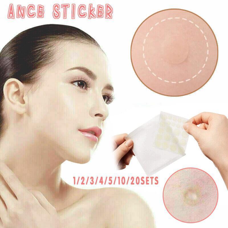 Acne Pimple Master Patch 24 Patches Blemish Control Genuine New Sealed-0