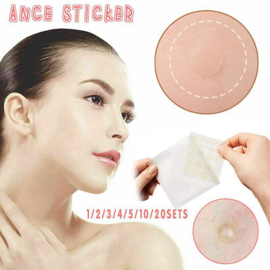 Acne Pimple Master Patch 24 Patches Blemish Control Genuine New Sealed-0